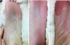 baby foot peeling renewal mask remove dead skin cuticles heel 