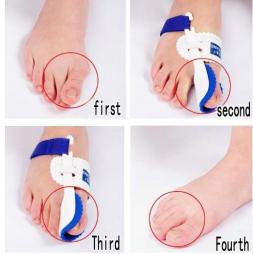  2013 New Hotsale Beetle-crusher Bone Ectropion Toes outer Appliance Professional Technology Health Care Products